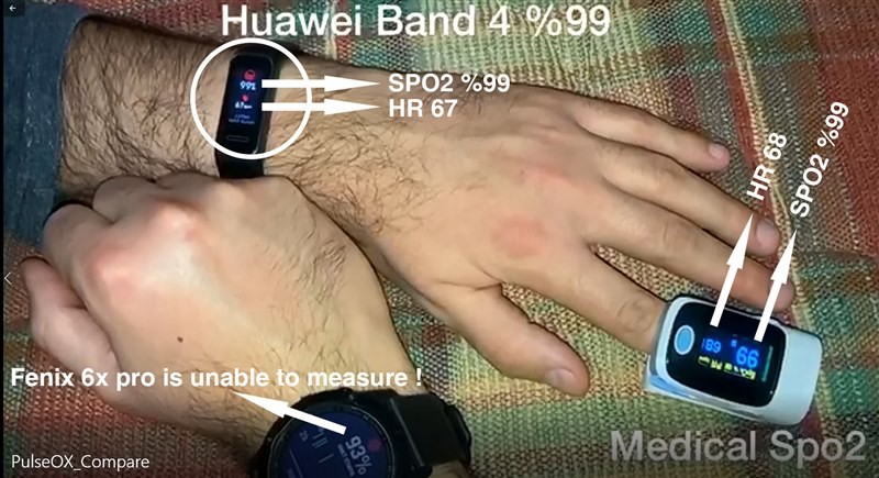 Huawei_vs_Garmin.jpg